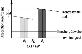 Angiographie