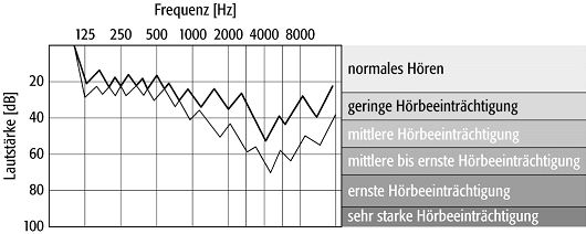 Audiometer