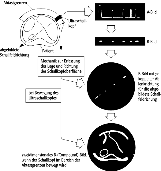 B-Bild-Verfahren