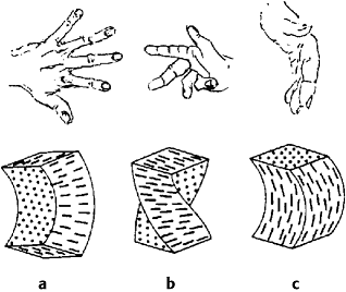 Deformationszustände in Flüssigkristallen