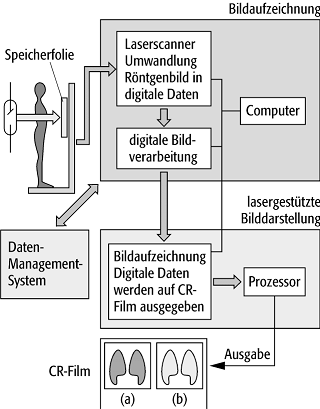 digitale Lumineszenz-Radiographie