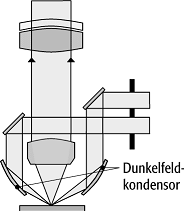 Dunkelfeldmikroskopie