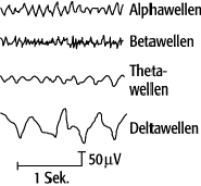 Elektroenzephalographie