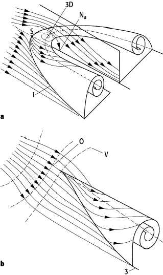 Grenzschichtablösung